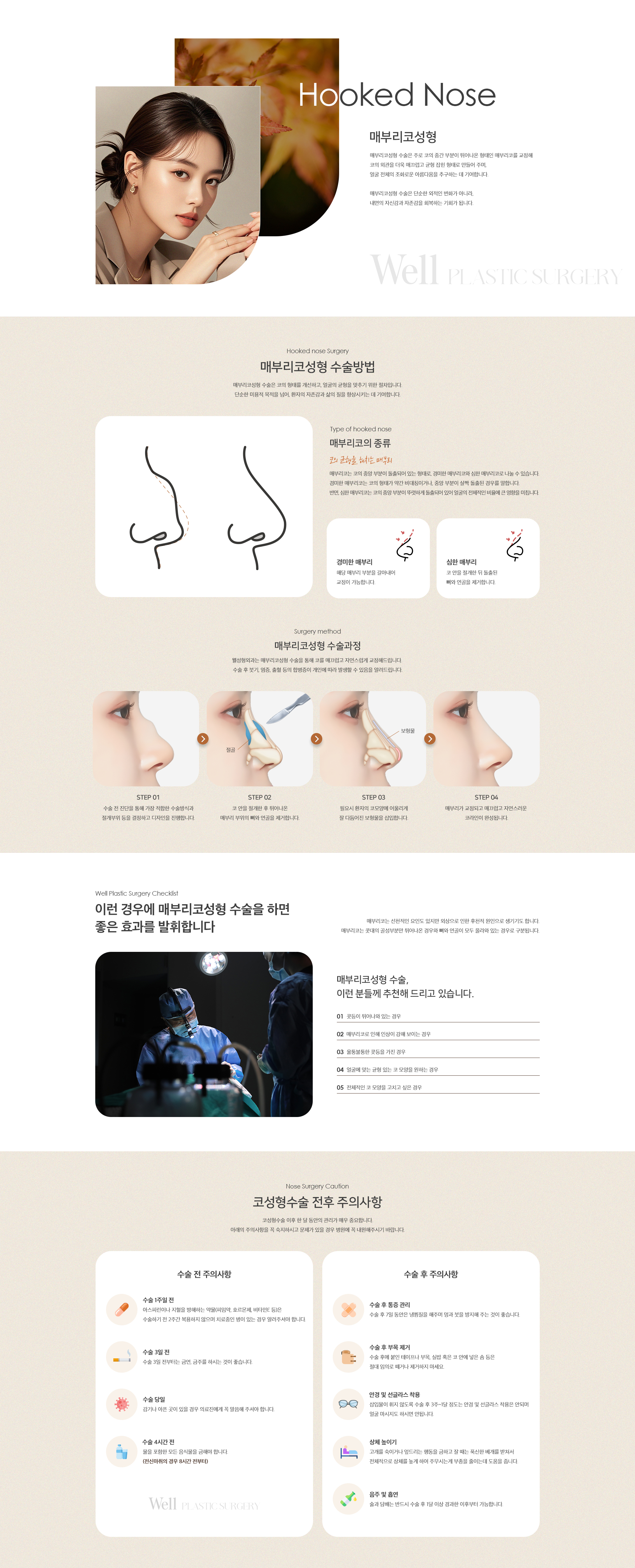 매부리코성형
