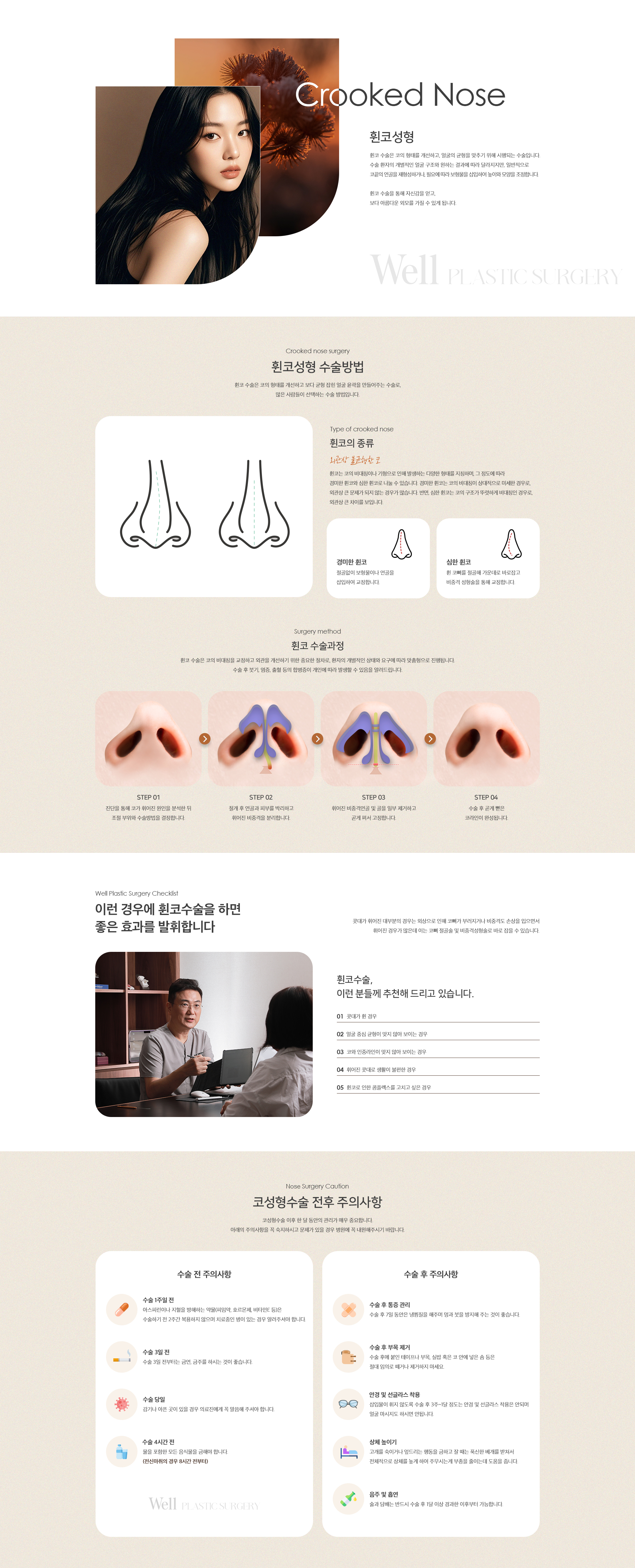 휜코성형