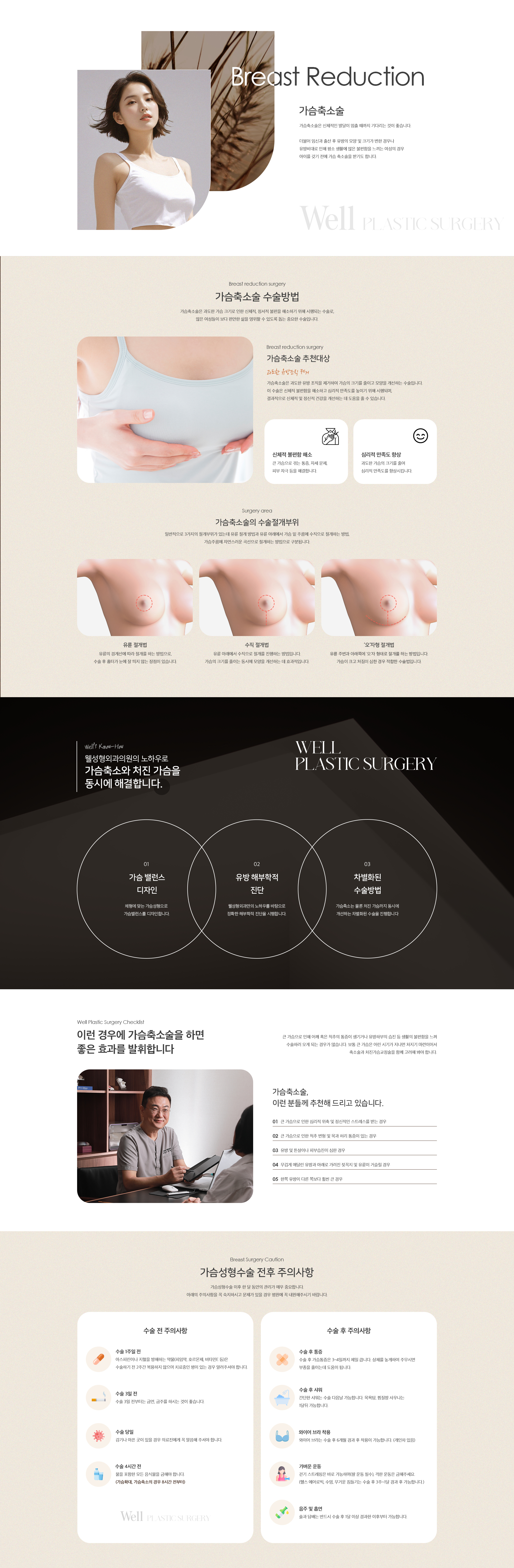 가슴축소술