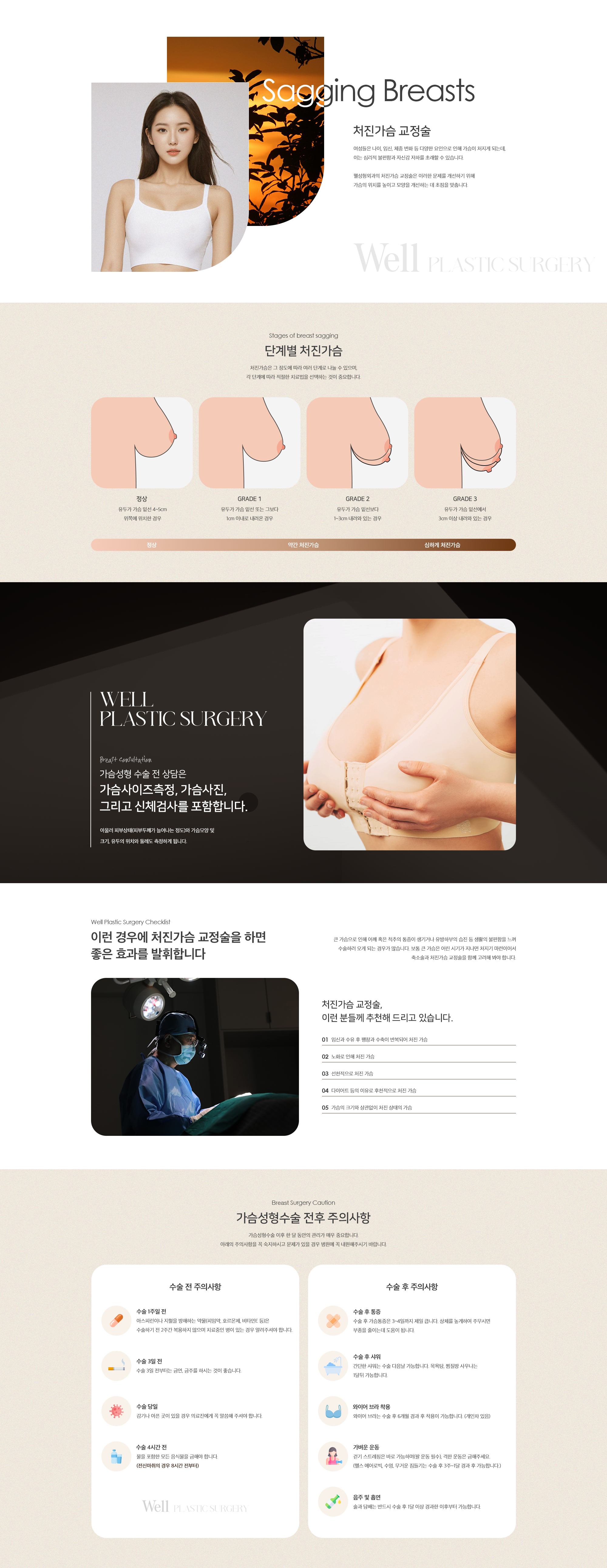 처진가슴교정술