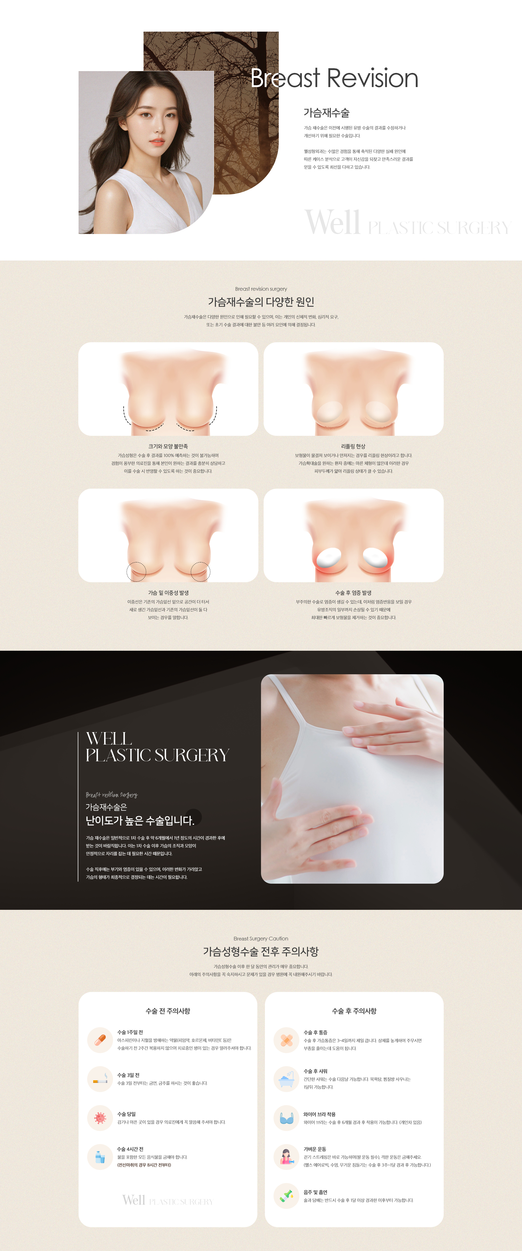 가슴재수술